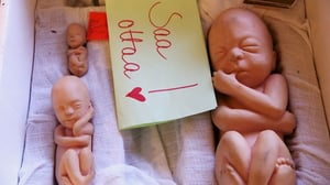 Spotlight: Onko aborttioikeus uhattuna?: 09.02.2016 11.00