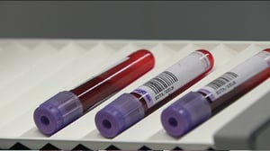 Yle Uutisluokka Triplet: HUSLAB käytti likaisia neuloja verinäytteiden ottoon (S): 01.04.2016 12.10