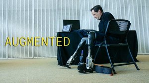 Proteesien vallankumous