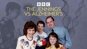 Tiede vastaan Alzheimer