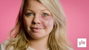 Tervetuloa vastaanotolle: 15.06.2021 06.00