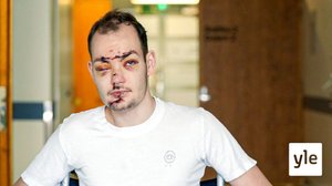 Skuuttailun kahdet kasvot: 11.04.2022 00.01