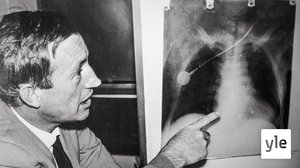 Historia: Ensimmäinen sydänsiirto: 09.03.2020 06.00