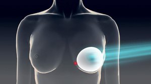 Kauneuskirurgian varjot: 09.01.2018 15.00