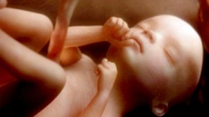 Tiededokumentti: Toivoa kohdunsiirrosta: 16.04.2018 15.05