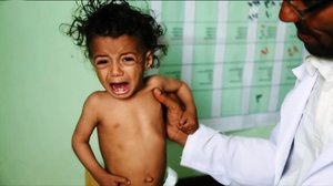 Jemenissä jo viisi miljoonaa lasta näkee nälkää : 20.09.2018 10.21