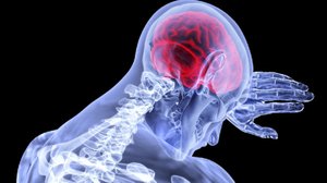 Nauru lepuuttaa stressaantuneita aivoja: 15.03.2019 12.23