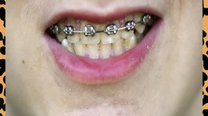 Asioita, jotka jännittävät (S) (S): 01.07.2019 00.01