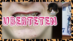 Miksi pikkuhousuihin tulee vaaleaa vuotoa? (S): 01.09.2019 00.01