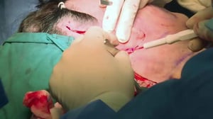 Kauneusleikkauksia Thaimaassa - Leidit lomalla