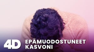 4D: Epämuodostuneet kasvoni - 4D: Epämuodostuneet kasvoni