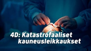 4D: Katastrofaaliset kauneusleikkaukset (7) - 4D: Katastrofaaliset kauneusleikkaukset