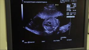 70 pientä sydäntä