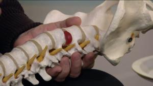 Aamutohtori: selkä- ja iskiaskipu