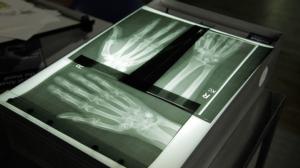 Tiededokumentti: Ihmisen mekaniikka: 25.02.2016 21.00