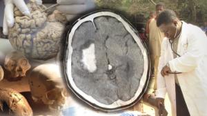 Tiededokumentti: Sairauksien alkuperä: 04.02.2016 21.00