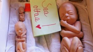 Spotlight: Onko aborttioikeus uhattuna?: 09.02.2016 11.00