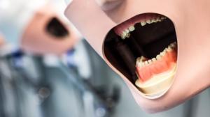 Akuutti: 25.04.2016 18.30