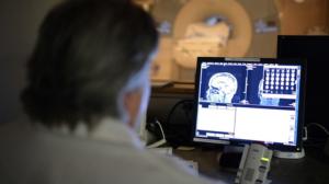 Tiededokumentti: Ennaltaehkäise Alzheimer: 29.09.2016 21.00