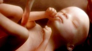 Tiededokumentti: Toivoa kohdunsiirrosta: 16.04.2018 15.05