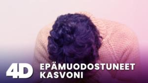 4D: Epämuodostuneet kasvoni - 4D: Epämuodostuneet kasvoni