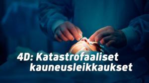 4D: Katastrofaaliset kauneusleikkaukset (7) - 4D: Katastrofaaliset kauneusleikkaukset